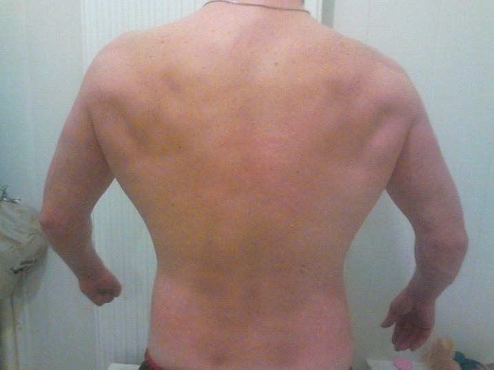 foto van men achterkant