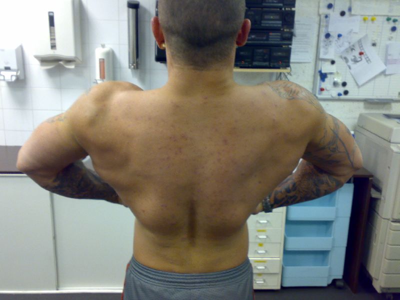 lat spread