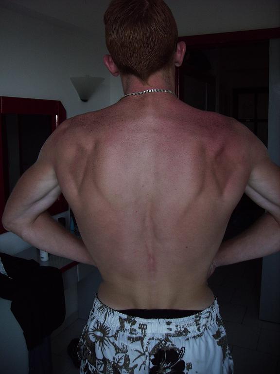 lat spread