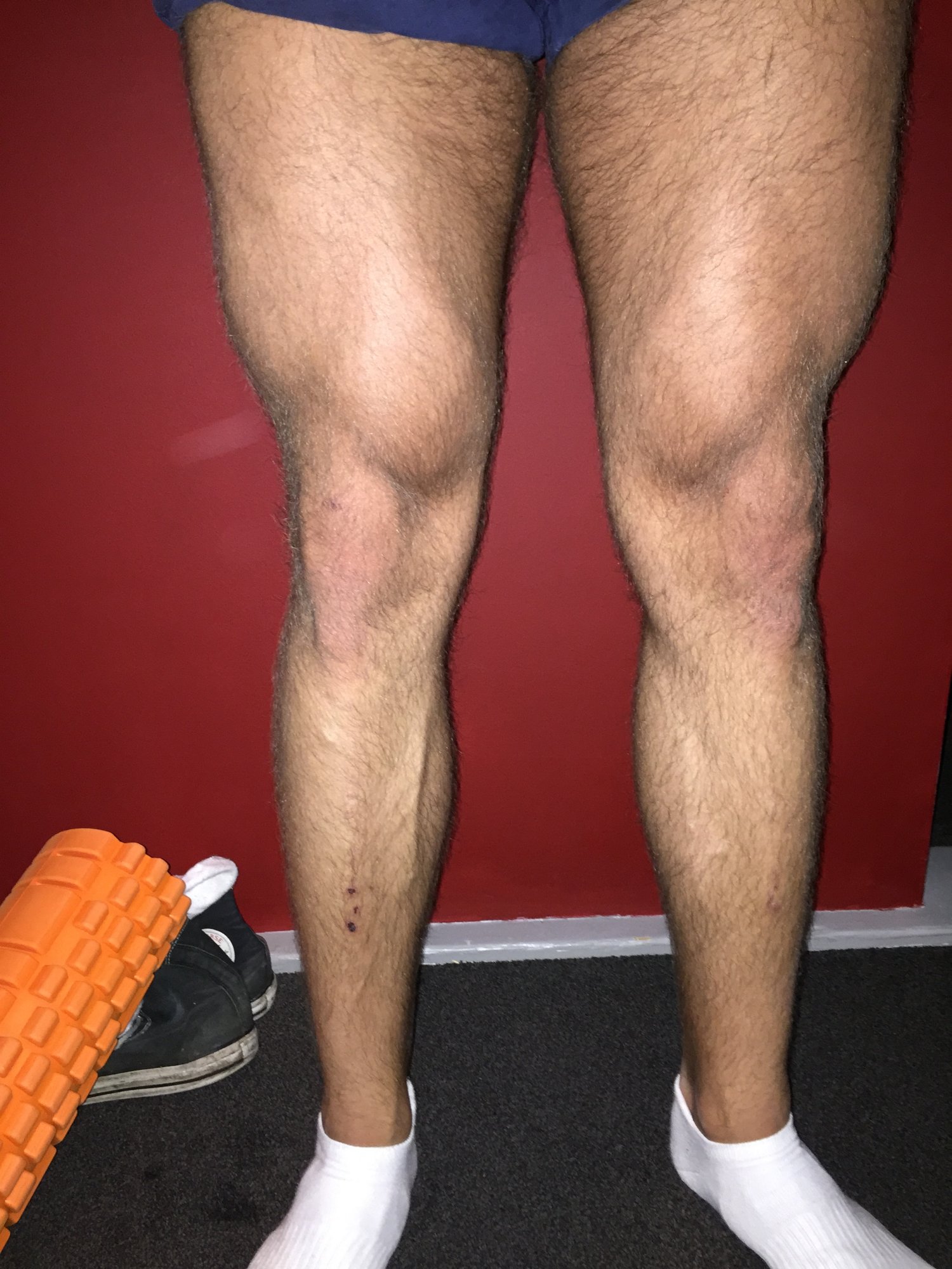 Legs eind bulk