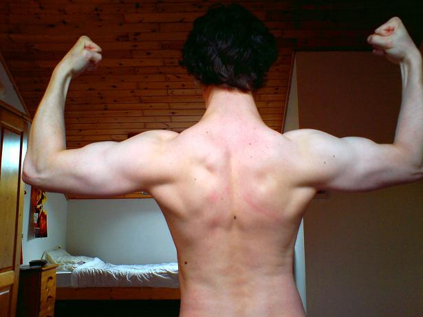 mijn rug (ongeveer 3 weken geleden)