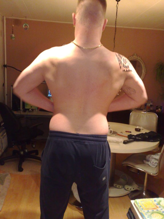 Muscle back