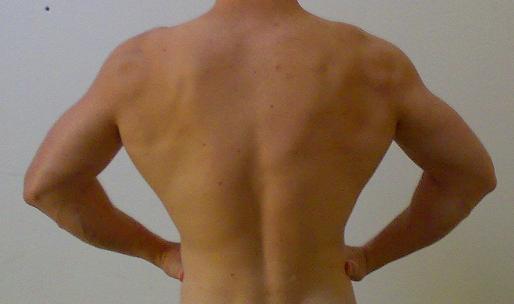 Rug 2 maanden geleden