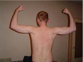 Rug na 6 weken basic inkomen