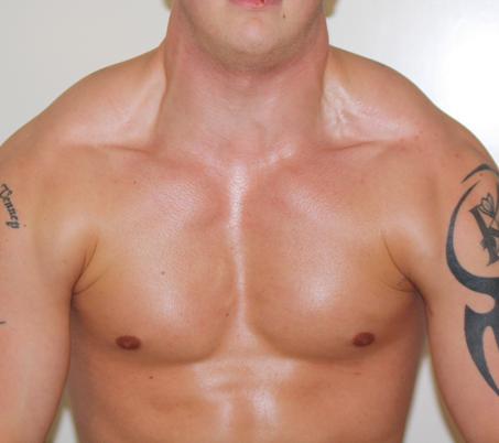 traps na 7x290kg shrugs