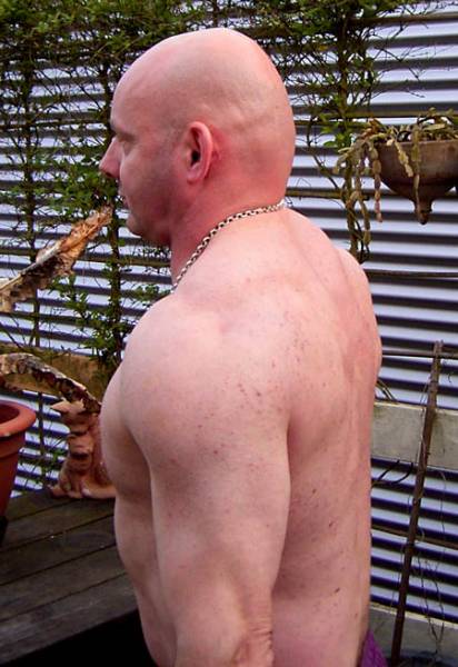 Tricepc/schouder na 5 maanden