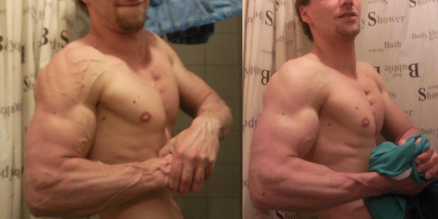 vasculaire pose vs gewone pose.