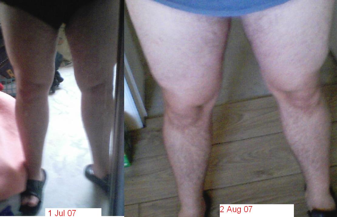 Vergelijking benen na 1 maand